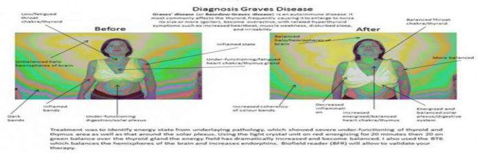 Aura Pictures Aura Scans What does aura mean? What constitutes an Aura Scan What do the Aura Colours Mean